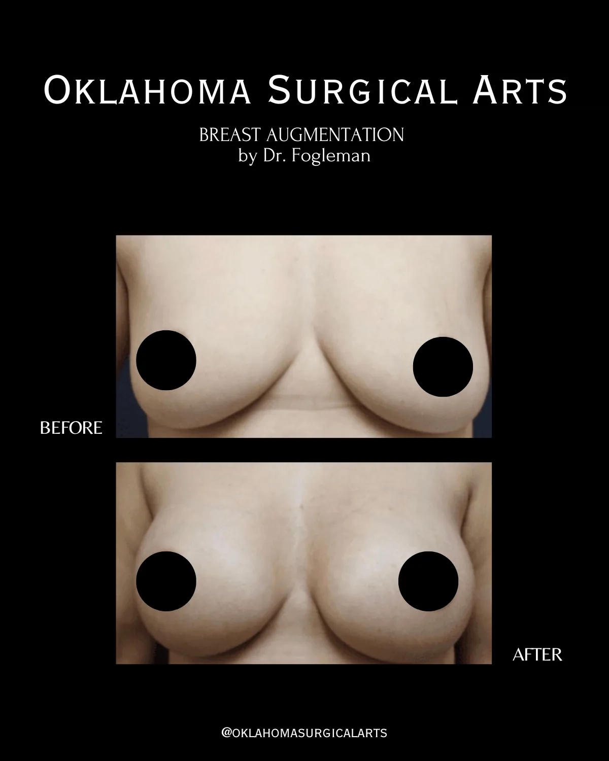 Trent Fogleman, Md