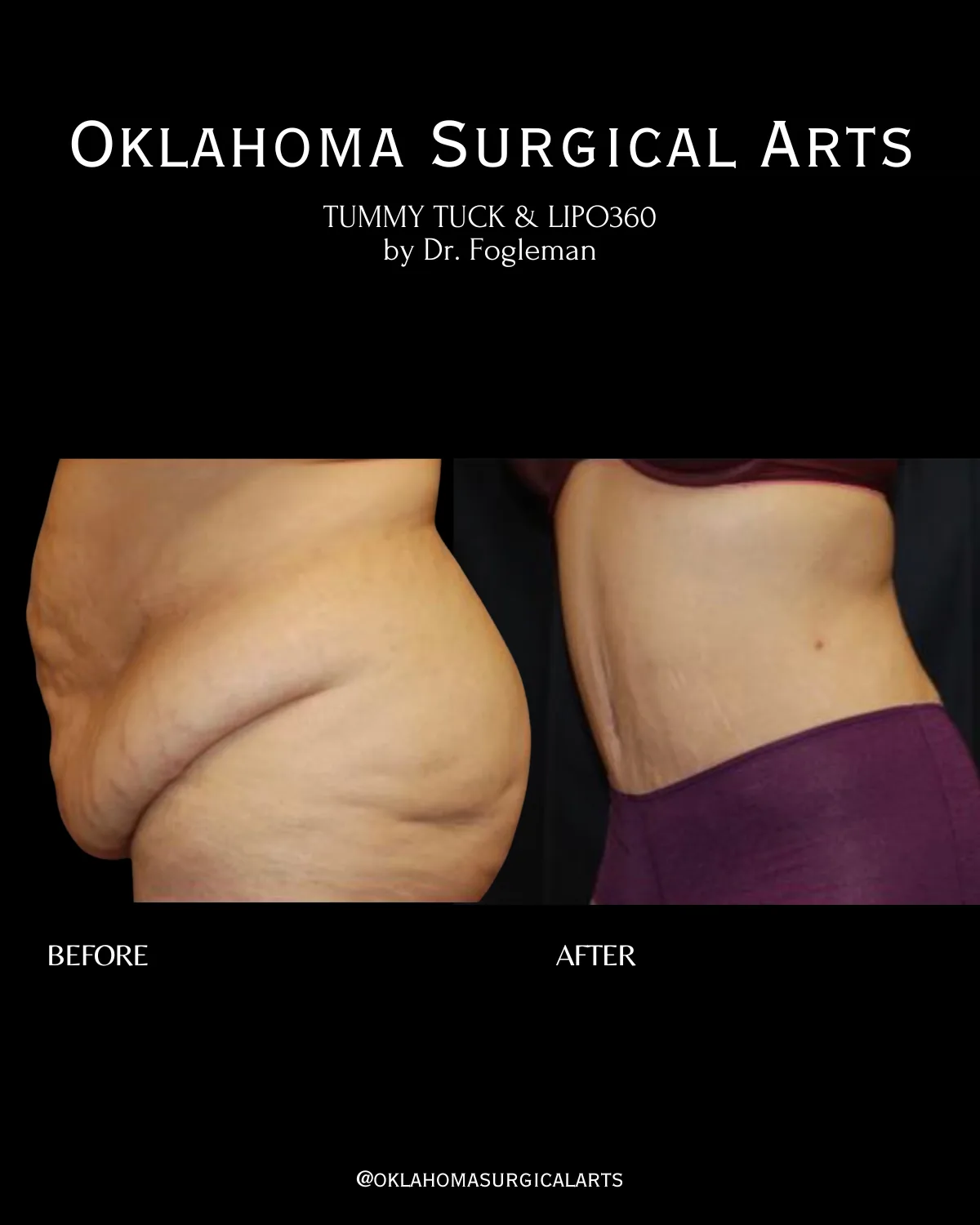 Trent Fogleman, Md